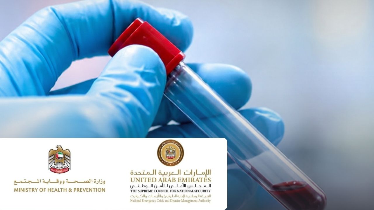 UAE Says Health System Ready to Monitor Ebola